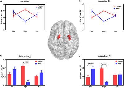 Uric Acid Has Different Effects on Spontaneous Brain Activities of Males and Females: A Cross-Sectional Resting-State Functional MR Imaging Study